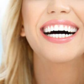 Tratamientos - Estetica Dental