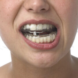 Tratamientos - Ferula Dental