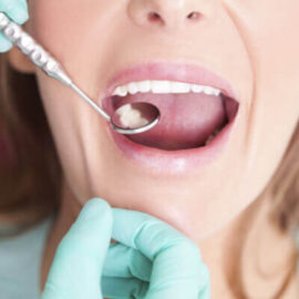 Tratamientos - Odontologia Conservadora